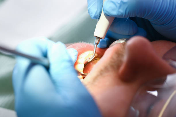 Best Walk-In Emergency Dentist in Portola Valley, CA