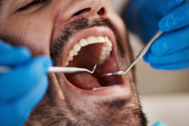 Best Emergency Dental Care for Trauma or Injury in Portola Valley, CA